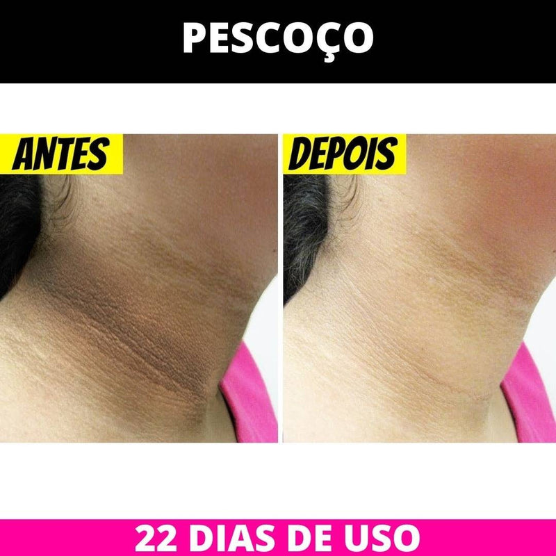 CLAREADOR DE MANCHAS DE PELE