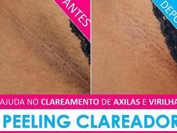 CLAREADOR DE MANCHAS DE PELE